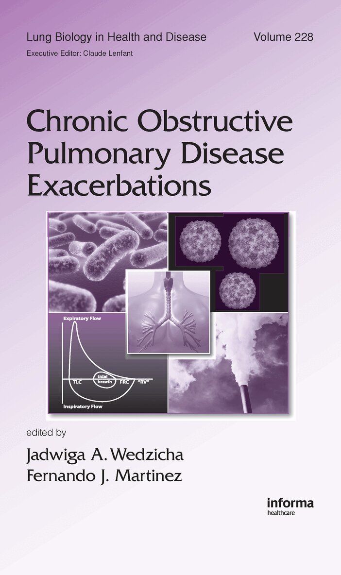 Jadwiga A. Wedzicha, Fernando J. Martinez - Chronic Obstructive Pulmonary Disease Exacerbations, Inbunden