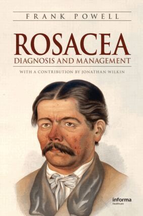 Frank Powell - Rosacea, Inbunden