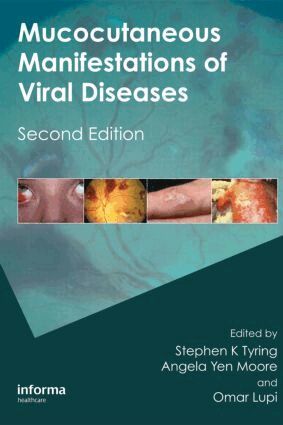 Stephen Tyring, Angela Yen Moore, Omar Lupi - Mucocutaneous Manifestations of Viral Diseases, Inbunden