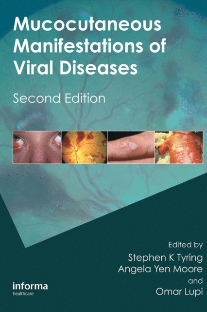 Omar Lupi, Angela Yen Moore, Stephen Tyring - Mucocutaneous Manifestations of Viral Diseases, E-bok