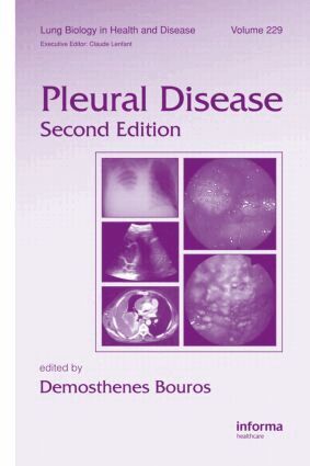 Demosthenes Bouros - Pleural Disease, Inbunden. Tillgänglighet: Lägg i varukorg