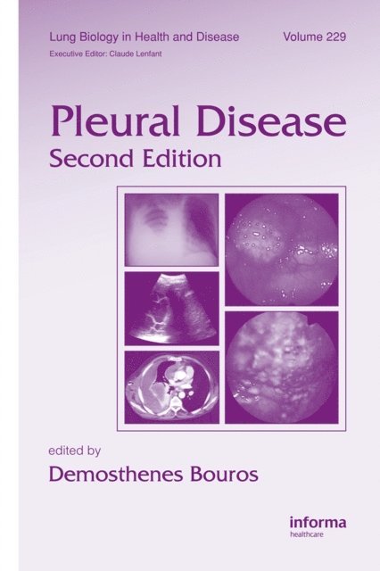 Demosthenes Bouros - Pleural Disease, E-bok. Tillgänglighet: Lägg i varukorg