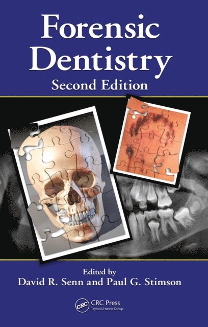 Paul G. Stimson, David R. Senn - Forensic Dentistry, E-bok