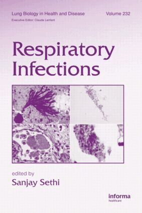 Sanjay Sethi - Respiratory Infections, Inbunden. Tillgänglighet: Lägg i varukorg