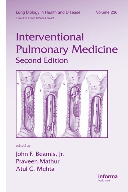 Atul C. Mehta, Praveen Mathur, Jr. John F. Beamis - Interventional Pulmonary Medicine, E-bok