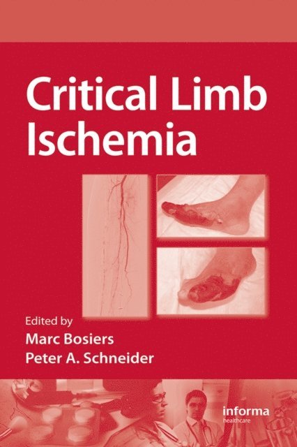 Peter Schneider, Marc Bosiers - Critical Limb Ischemia, E-bok