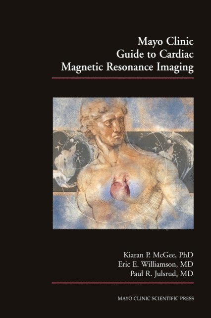 Paul Julsrud, Eric E. Williamson, Kiaran P. McGee - Mayo Clinic Guide to Cardiac Magnetic Resonance Imaging, E-bok