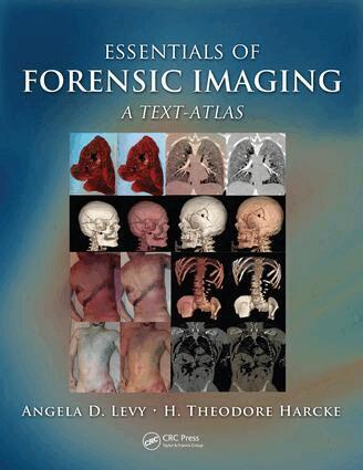 Angela D. Levy, H. Theodore Harcke, Jr. - Essentials of Forensic Imaging, E-bok