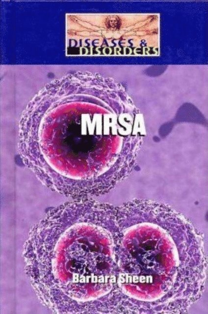 Barbara Sheen - MRSA, E-bok