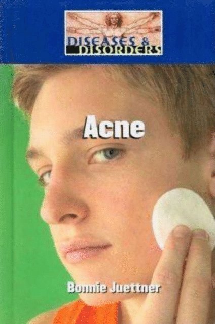 Bonnie Juettner - Acne, E-bok