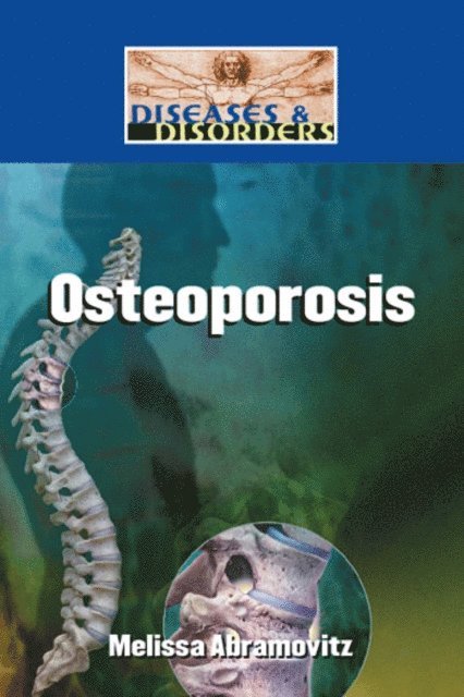 Melissa Abramovitz - Osteoporosis, E-bok