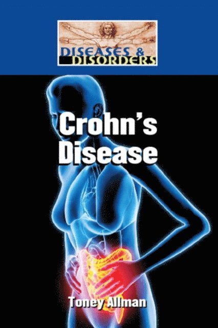 Toney Allman - Crohn's Disease, E-bok