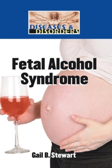 Gail B. Stewart - Fetal Alcohol Syndrome, E-bok. Tillgänglighet: Lägg i varukorg