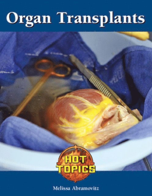 Melissa Abramovitz - Organ Transplants, E-bok