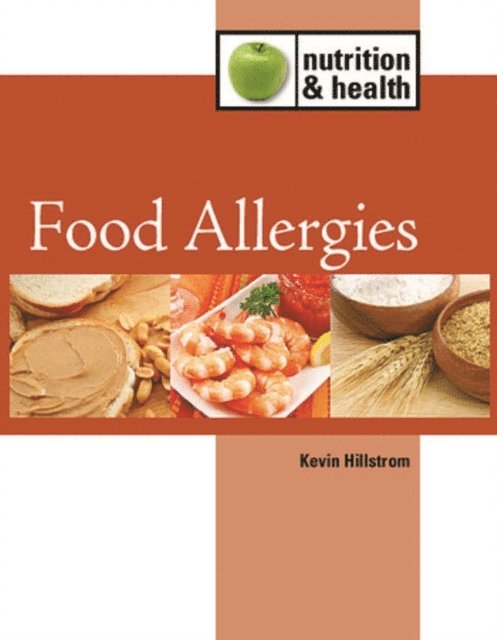 Kevin Hillstrom - Food Allergies, E-bok