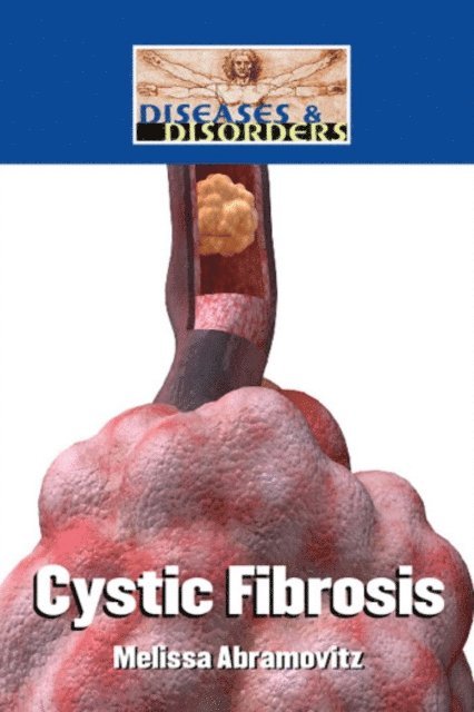 Melissa Abramovitz - Cystic Fibrosis, E-bok