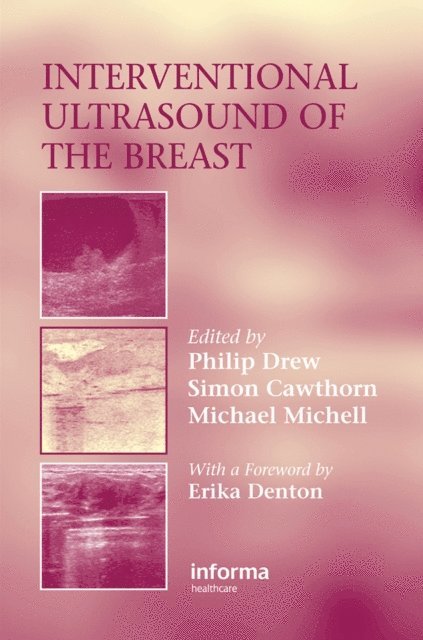 Michael Michell, Simon Cawthorn, Philip Drew - Interventional Ultrasound of the Breast, E-bok