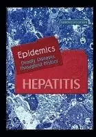Aileen Gallagher - Hepatitis, Häftad. Tillgänglighet: Lägg i varukorg