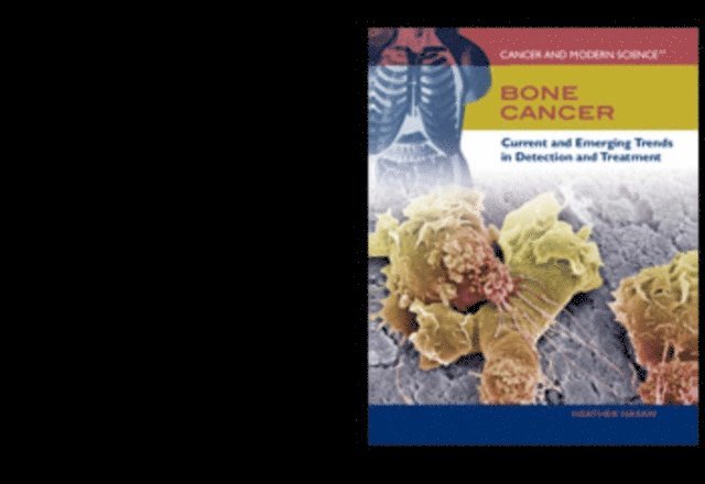 Heather Hasan - Bone Cancer, E-bok