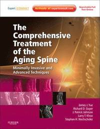 The Comprehensive Treatment of the Aging Spine
