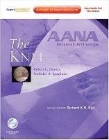 AANA Advanced Arthroscopy: The Knee