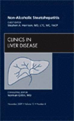 Stephen A. Harrison - Non-Alcoholic Steatohepatitis, An Issue of Clinics in Liver Disease, Inbunden. Tillgänglighet: Lägg i varukorg