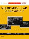 Neuromuscular Ultrasound
