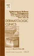 D�d�e F. Murrell - Epidermolysis Bullosa: Part I - Pathogenesis and Clinical Features, An Issue of Dermatologic Clinics, Inbunden. Tillgänglighet: Lägg i varukorg