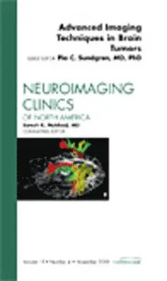 Pia C. Sundgren - Advanced Imaging Techniques in Brain Tumors, An Issue of Neuroimaging Clinics, Inbunden. Tillgänglighet: Lägg i varukorg