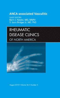Barrie J. Fessler, S. Louis Bridges Jr. - ANCA-Associated Vasculitis, An Issue of Rheumatic Disease Clinics, Inbunden