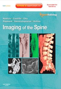 Imaging of the Spine E-Book
