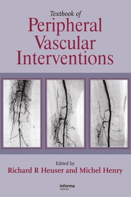 Michel Henry, Richard R. Heuser - Textbook of Peripheral Vascular Interventions, E-bok