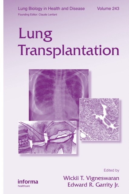Edward Garrity, Wickii Vigneswaran - Lung Transplantation, E-bok