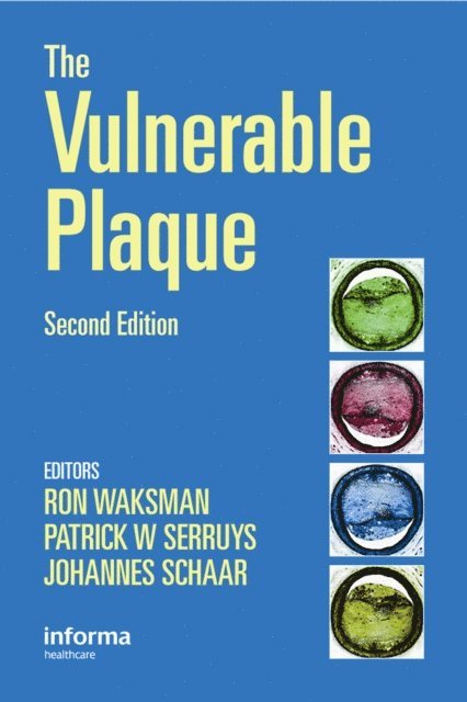Johannes Schaar, Patrick W. Serruys, Ron Waksman - Handbook of the Vulnerable Plaque, E-bok