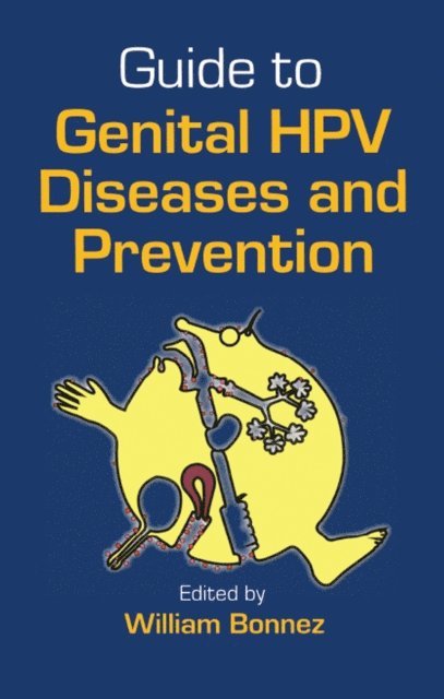 William Bonnez - Guide to Genital HPV Diseases and Prevention, E-bok. Tillgänglighet: Lägg i varukorg