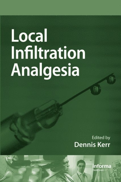 Dennis R. Kerr - Local Infiltration Analgesia, E-bok. Tillgänglighet: Lägg i varukorg