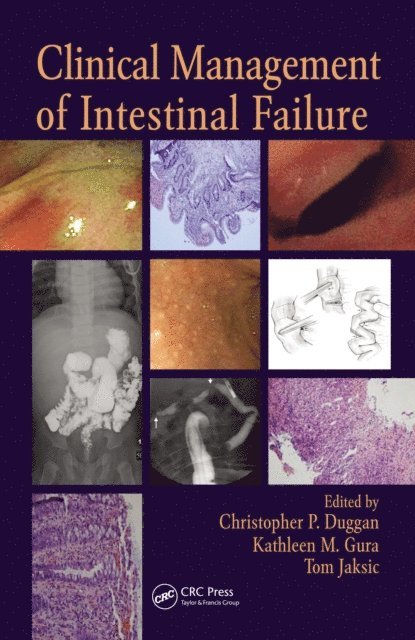 Tom Jaksic, Kathleen M. Gura, Christopher P. Duggan - Clinical Management of Intestinal Failure, E-bok