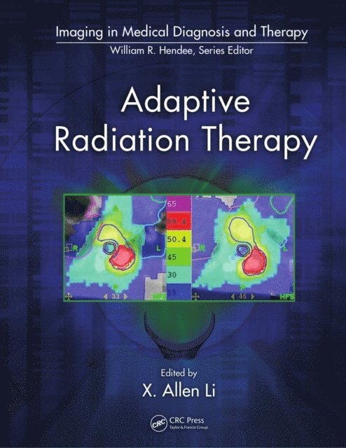 X. Allen Li - Adaptive Radiation Therapy, E-bok