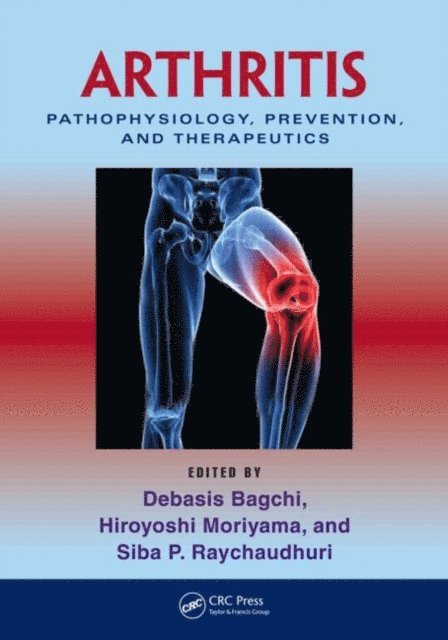 Siba P. Raychaudhuri, Hiroyoshi Moriyama, Debasis Bagchi - Arthritis, E-bok