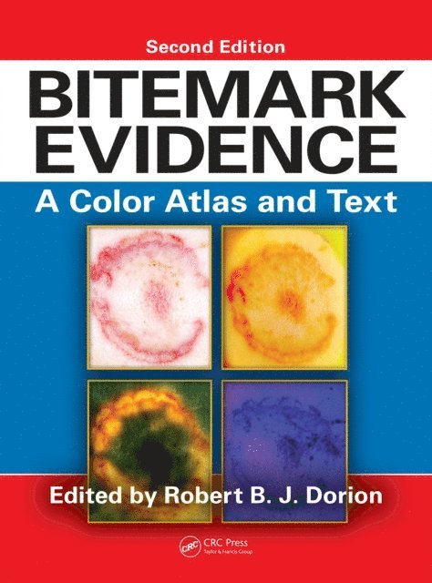 Robert B.J. Dorion - Bitemark Evidence, E-bok