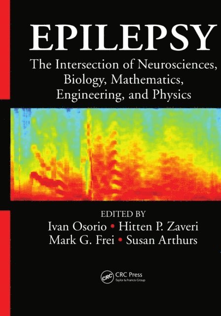 Susan Arthurs, Mark G. Frei, Hitten P. Zaveri, Ivan Osorio - Epilepsy, E-bok
