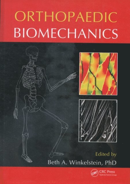Beth A. Winkelstein - Orthopaedic Biomechanics, E-bok. Tillgänglighet: Lägg i varukorg