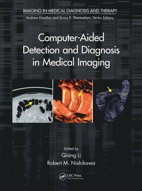 Robert M. Nishikawa, Qiang Li - Computer-Aided Detection and Diagnosis in Medical Imaging, E-bok