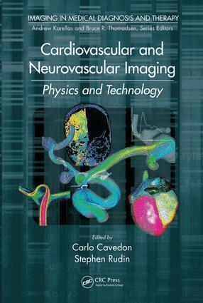 Carlo Cavedon, Stephen Rudin - Cardiovascular and Neurovascular Imaging, E-bok. Tillgänglighet: Lägg i varukorg