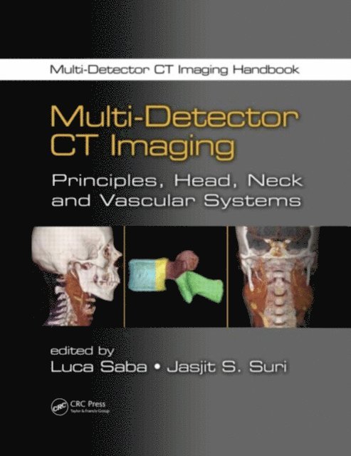 Jasjit S. Suri, Luca Saba - Multi-Detector CT Imaging, E-bok