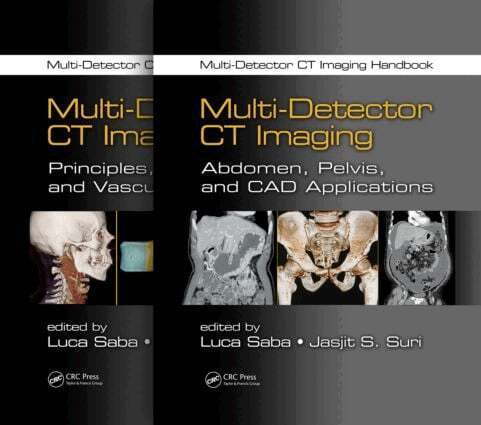 Luca Saba, Jasjit S. Suri - Multi-Detector CT Imaging Handbook, Two Volume Set, Övrigt