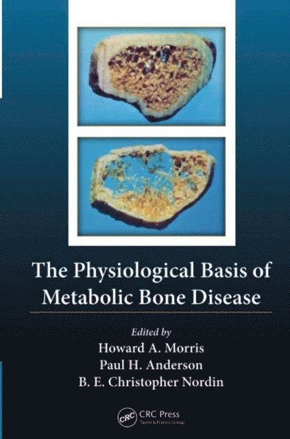 Paul Anderson, Howard Arthur Morris, Borje Edgar Christopher Nordin - Physiological Basis of Metabolic Bone Disease, E-bok
