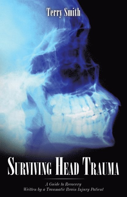 Terry Smith - Surviving Head Trauma, E-bok