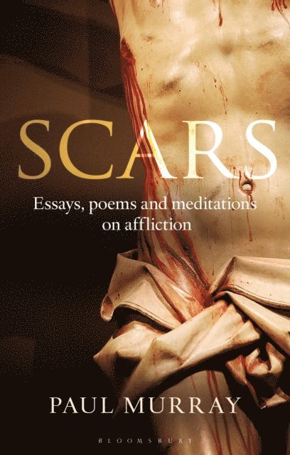 Paul Murray OP - Scars, E-bok
