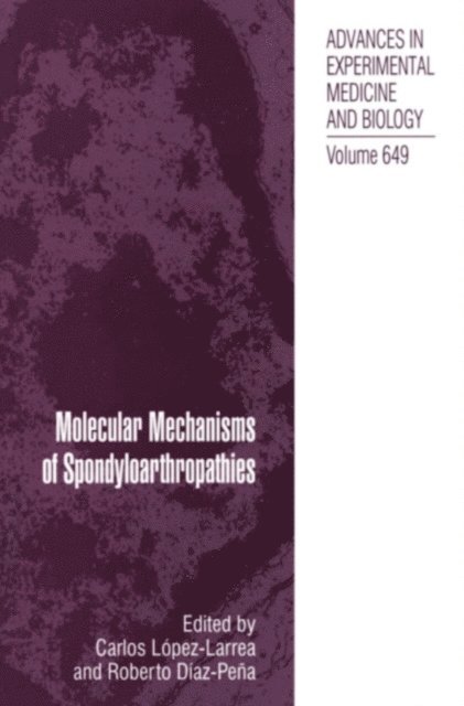 Roberto Diaz-Pena, Carlos Lopez-Larrea - Molecular Mechanisms of Spondyloarthropathies, E-bok. Tillgänglighet: Lägg i varukorg